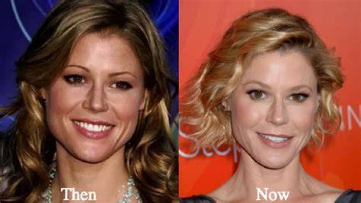 Julie Bowen plastic surgery