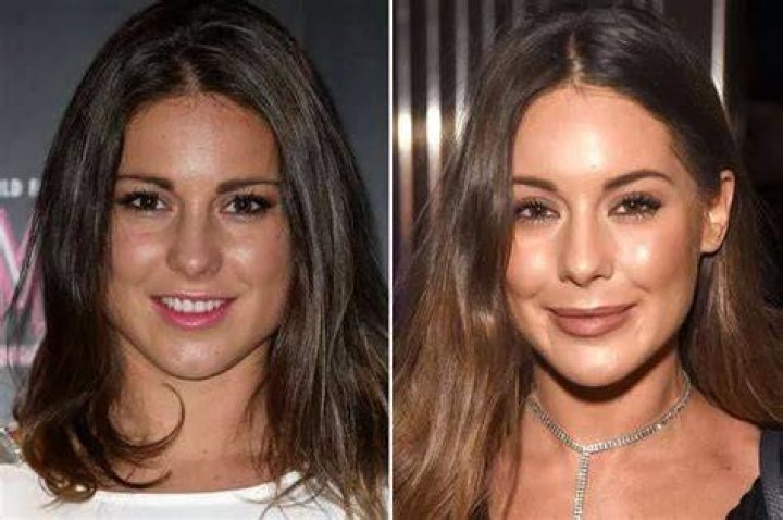 Louise Thompson Age