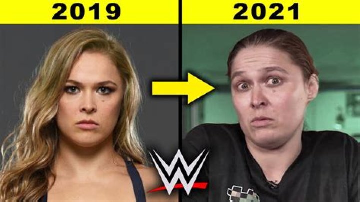 Ronda Rousey | Teeth Before And After